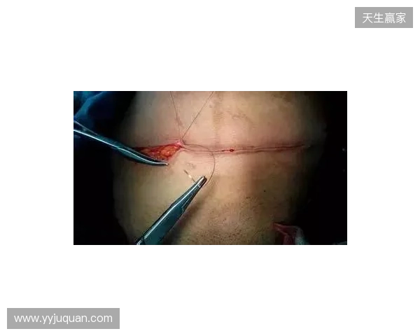 广州豹官方:杨浩眉弓伤口缝合30余针,预计5-7天后拆线 广州豹官方:杨浩眉弓伤口缝合30余针,预计5-7天后拆线